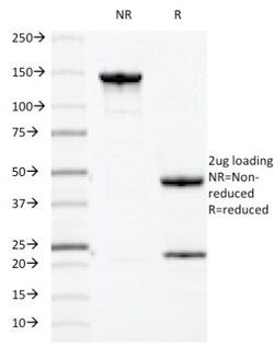MUC1 Antibody (HMPV), Novus Biologicals 0.2mg; Unlabeled:Antibodies, Monoclonal